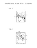 METHOD FOR TREATMENT OF PELVIC ORGAN PROLAPSE CONDITIONS diagram and image