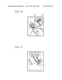 METHOD FOR TREATMENT OF PELVIC ORGAN PROLAPSE CONDITIONS diagram and image