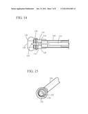 METHOD FOR TREATMENT OF PELVIC ORGAN PROLAPSE CONDITIONS diagram and image