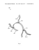 BODILY IMPLANTS AND METHODS OF TREATING FECAL INCONTINENCE USING BODILY     IMPLANTS diagram and image