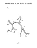 BODILY IMPLANTS AND METHODS OF TREATING FECAL INCONTINENCE USING BODILY     IMPLANTS diagram and image