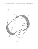 BODILY IMPLANTS AND METHODS OF TREATING FECAL INCONTINENCE USING BODILY     IMPLANTS diagram and image