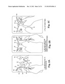 SURGICAL ARTICLES AND METHODS diagram and image