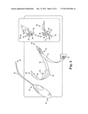 SURGICAL ARTICLES AND METHODS diagram and image