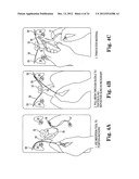 SURGICAL ARTICLES AND METHODS diagram and image