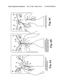 SURGICAL ARTICLES AND METHODS diagram and image