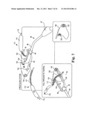 SURGICAL ARTICLES AND METHODS diagram and image