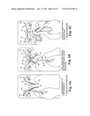 SURGICAL ARTICLES AND METHODS diagram and image