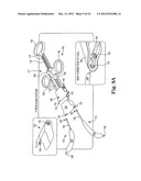 SURGICAL ARTICLES AND METHODS diagram and image