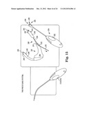 SURGICAL ARTICLES AND METHODS diagram and image