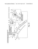 SURGICAL ARTICLES AND METHODS diagram and image