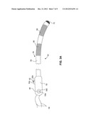 DISPOSABLE SHEATH diagram and image