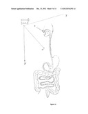 SPHERICAL CAPSULE VIDEO ENDOSCOPY diagram and image