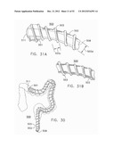 ROTATE-TO-ADVANCE CATHETERIZATION SYSTEM diagram and image