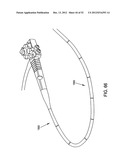 ROTATE-TO-ADVANCE CATHETERIZATION SYSTEM diagram and image