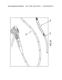 ROTATE-TO-ADVANCE CATHETERIZATION SYSTEM diagram and image