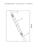 ROTATE-TO-ADVANCE CATHETERIZATION SYSTEM diagram and image