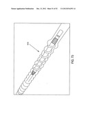 ROTATE-TO-ADVANCE CATHETERIZATION SYSTEM diagram and image