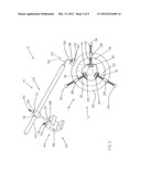 Surgical tissue retractor diagram and image