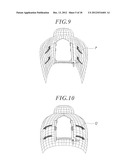 RIB SPREADER diagram and image