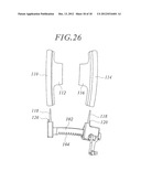 RIB SPREADER diagram and image