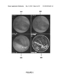 SYSTEM AND METHOD FOR AUTOMATED DISEASE ASSESSMENT IN CAPSULE ENDOSCOPY diagram and image