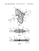 Catheter Device with Local Magnetic Resonance Imaging Coil and Methods for     Use Thereof diagram and image