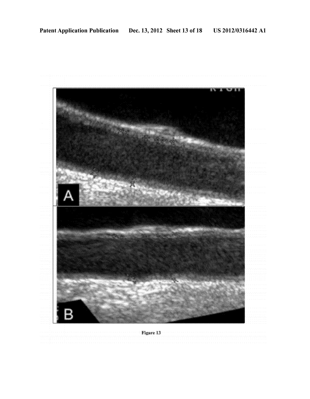 Hypothesis Validation of Far Wall Brightness in Arterial Ultrasound - diagram, schematic, and image 14