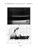 Hypothesis Validation of Far Wall Brightness in Arterial Ultrasound diagram and image