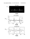 METHOD FOR DETERMINING A HEART PERIOD FROM AN ECG WAVEFORM USING IMAGE     REPRESENTATION OF ECG diagram and image