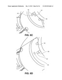 FLUID DELIVERY SYSTEM WITH PRESSURE MONITORING DEVICE diagram and image