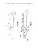 Safety Syringe Having A Manually Activated Retractable Needle diagram and image