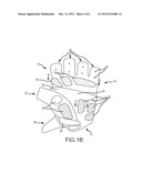 PADDED CYCLING GLOVE THAT REDUCES NERVE INJURY diagram and image