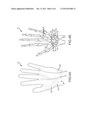 PADDED CYCLING GLOVE THAT REDUCES NERVE INJURY diagram and image