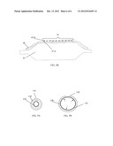 DRUG DELIVERY DEVICE WITH INSTABLE SHEATH AND/OR PUSH ELEMENT diagram and image