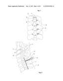 SURGICAL ACCESS DEVICE diagram and image