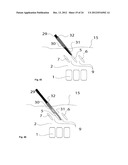 SURGICAL ACCESS DEVICE diagram and image