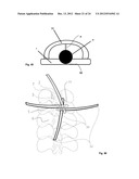 SURGICAL ACCESS DEVICE diagram and image