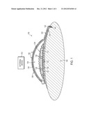 IMPLANTABLE DEVICE WITH CONFORMING TELEMETRY COIL AND METHODS OF MAKING     SAME diagram and image