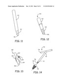 TOOLS FOR PERFORMING LESS INVASIVE ORTHOPEDIC JOINT PROCEDURES diagram and image