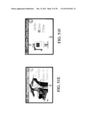 SYSTEMS AND METHODS FOR JOINT REPLACEMENT diagram and image