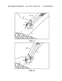 OFFSET JAW SUTURING DEVICE, SYSTEM, AND METHODS diagram and image