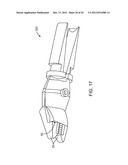 OFFSET JAW SUTURING DEVICE, SYSTEM, AND METHODS diagram and image