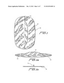 METHOD OF LAPAROSCOPIC HERNIA REPAIR USING SURGICAL MESH diagram and image