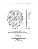 METHOD OF LAPAROSCOPIC HERNIA REPAIR USING SURGICAL MESH diagram and image