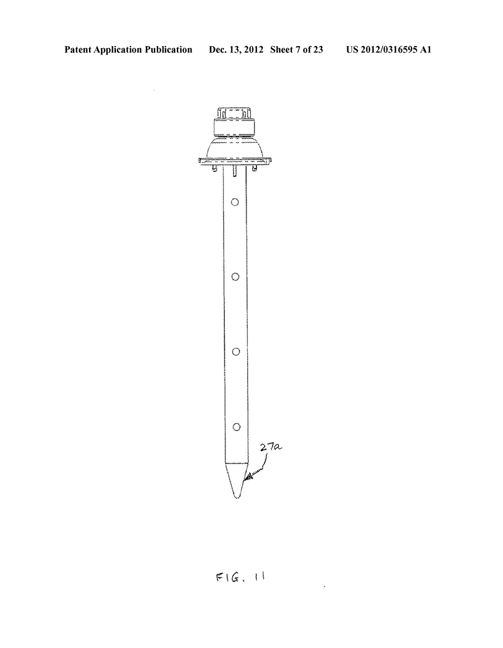 BLADELESS OPTICAL OBTURATOR - diagram, schematic, and image 08