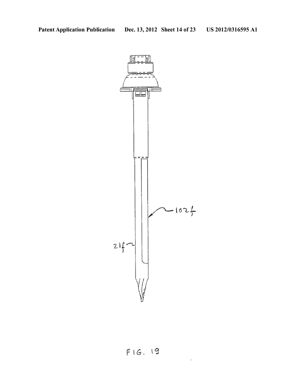 BLADELESS OPTICAL OBTURATOR - diagram, schematic, and image 15