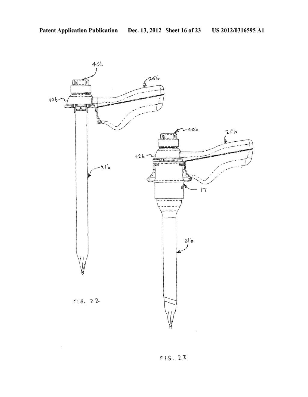 BLADELESS OPTICAL OBTURATOR - diagram, schematic, and image 17