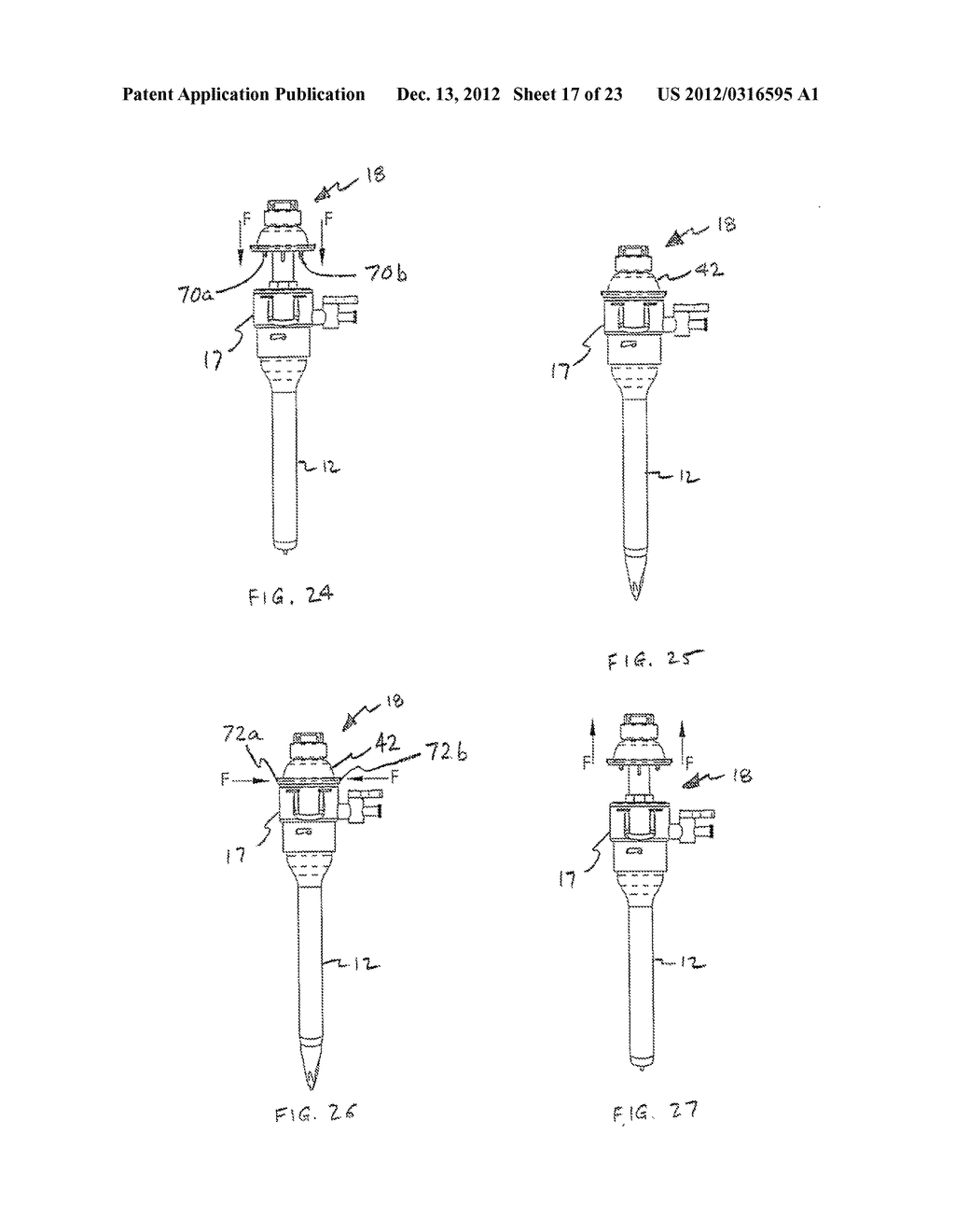 BLADELESS OPTICAL OBTURATOR - diagram, schematic, and image 18