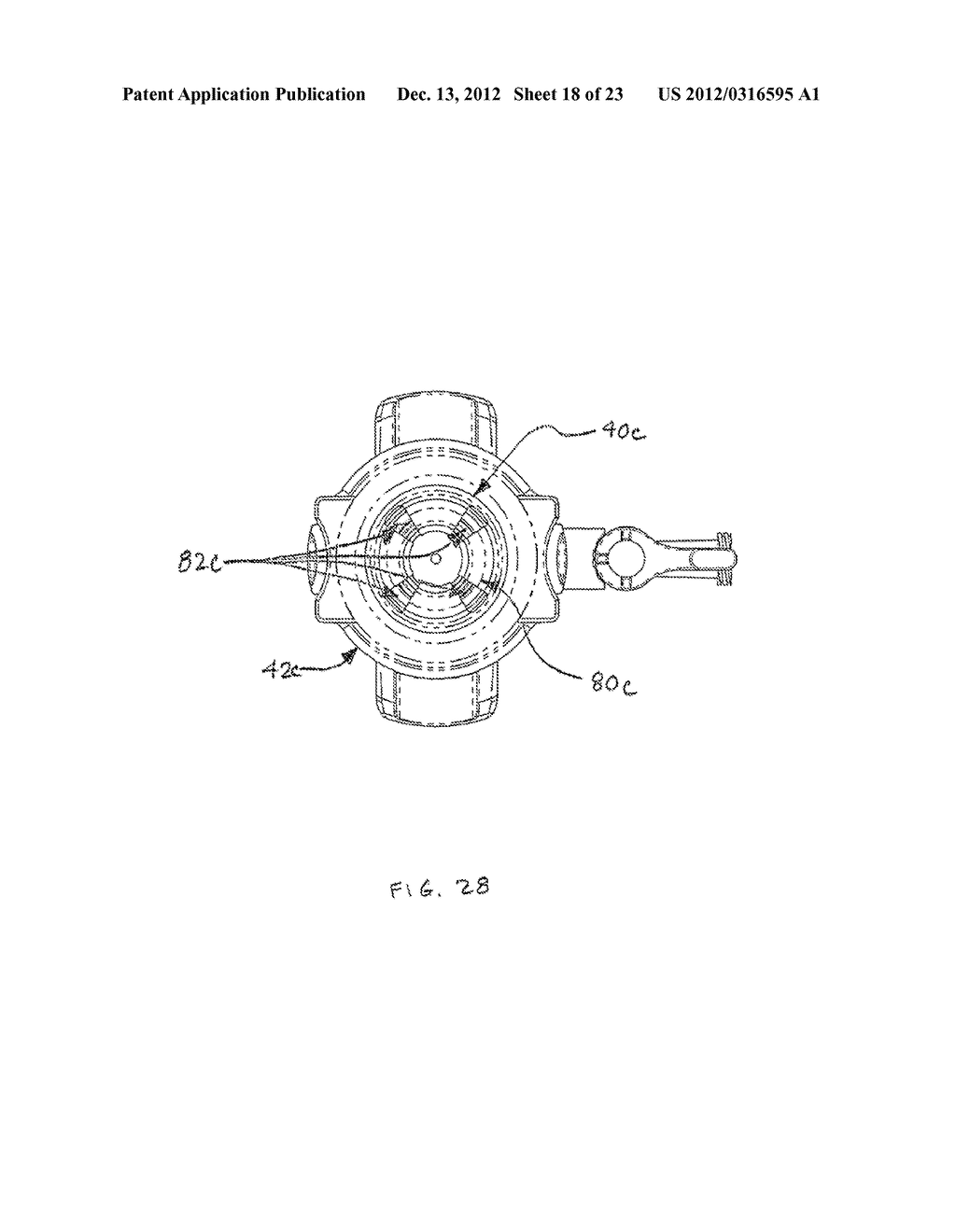 BLADELESS OPTICAL OBTURATOR - diagram, schematic, and image 19